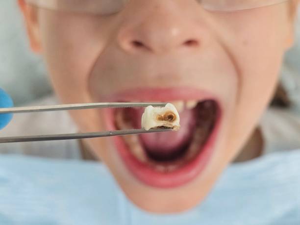 Best Same-Day Emergency Dental Services in New Athens, IL